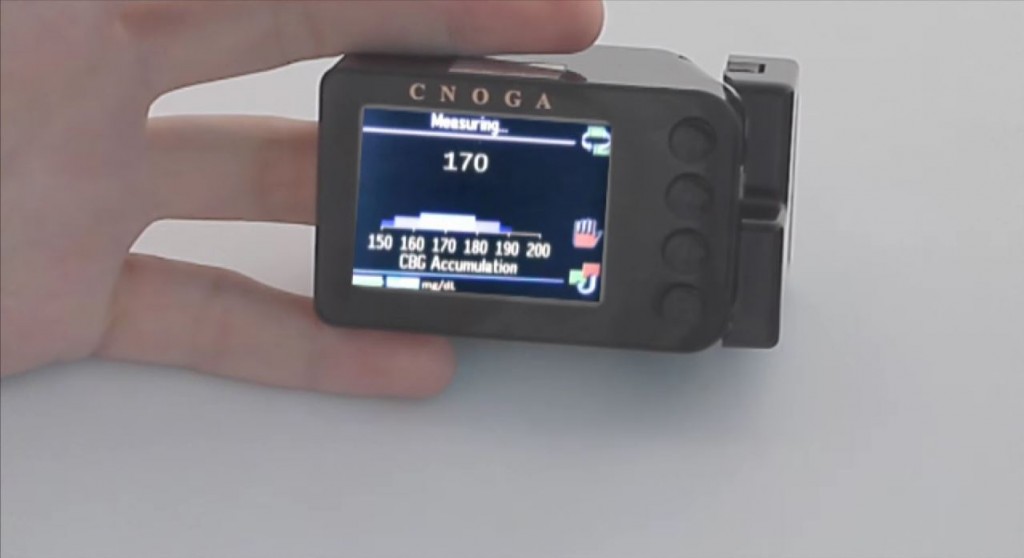 Cnoga Medical, an Israeli company, has developed a device that can monitor blood sugar levels in diabetics without drawing blood. Photo: Cnoga Medical / YouTube