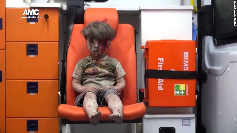 Omran Daqneesh survived a bombing in Aleppo. Photo: Aleppo Media Center